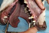 DETARTRAGE DENTS